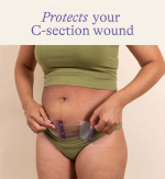 Lansinoh C-Section Hydrogel Pads 2s - Image 2